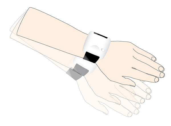 The Parkinson's KinetiGraph device measures body movement over 6-10 days to chart the onset and scope of Parkinson's disease.