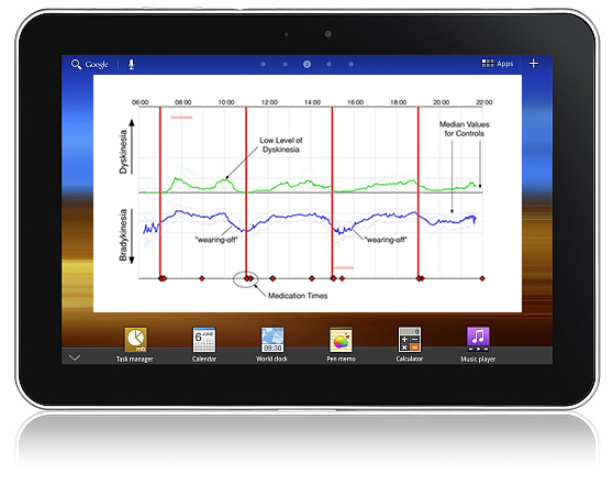 The PKG device by Global Kinetics Corporation generates information for the treatment and management of Parkinson's disease, and it is one of the international success stories of the MCRF.