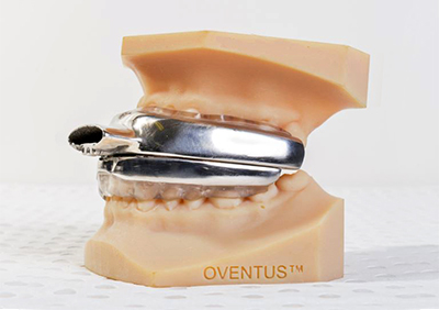 The O2Vent is customised to fit each individual's mouth and then 3D printed in titanium.
