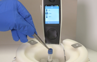 Bluechiip easily and safely monitors valuable medical samples kept in frozen stasis.